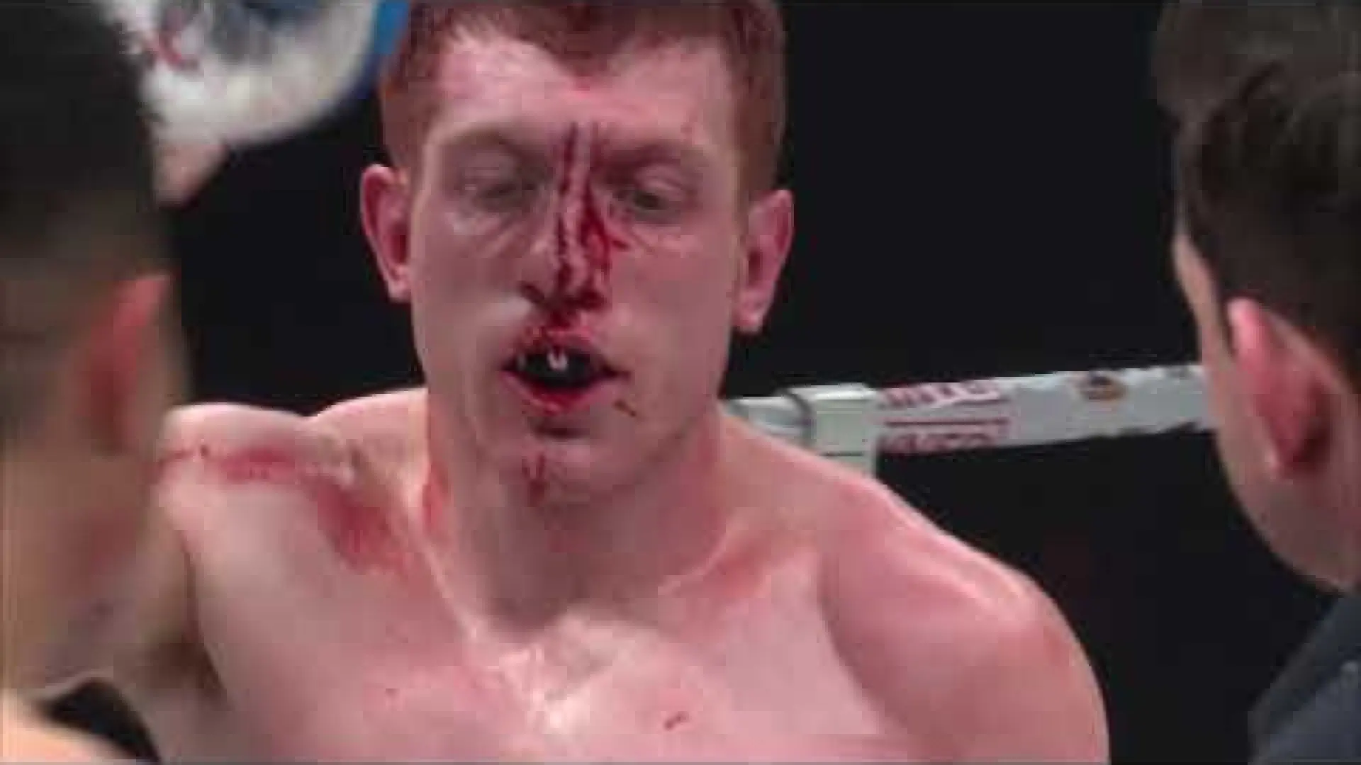Michael Pham vs Aaron Turner (Fight Video)