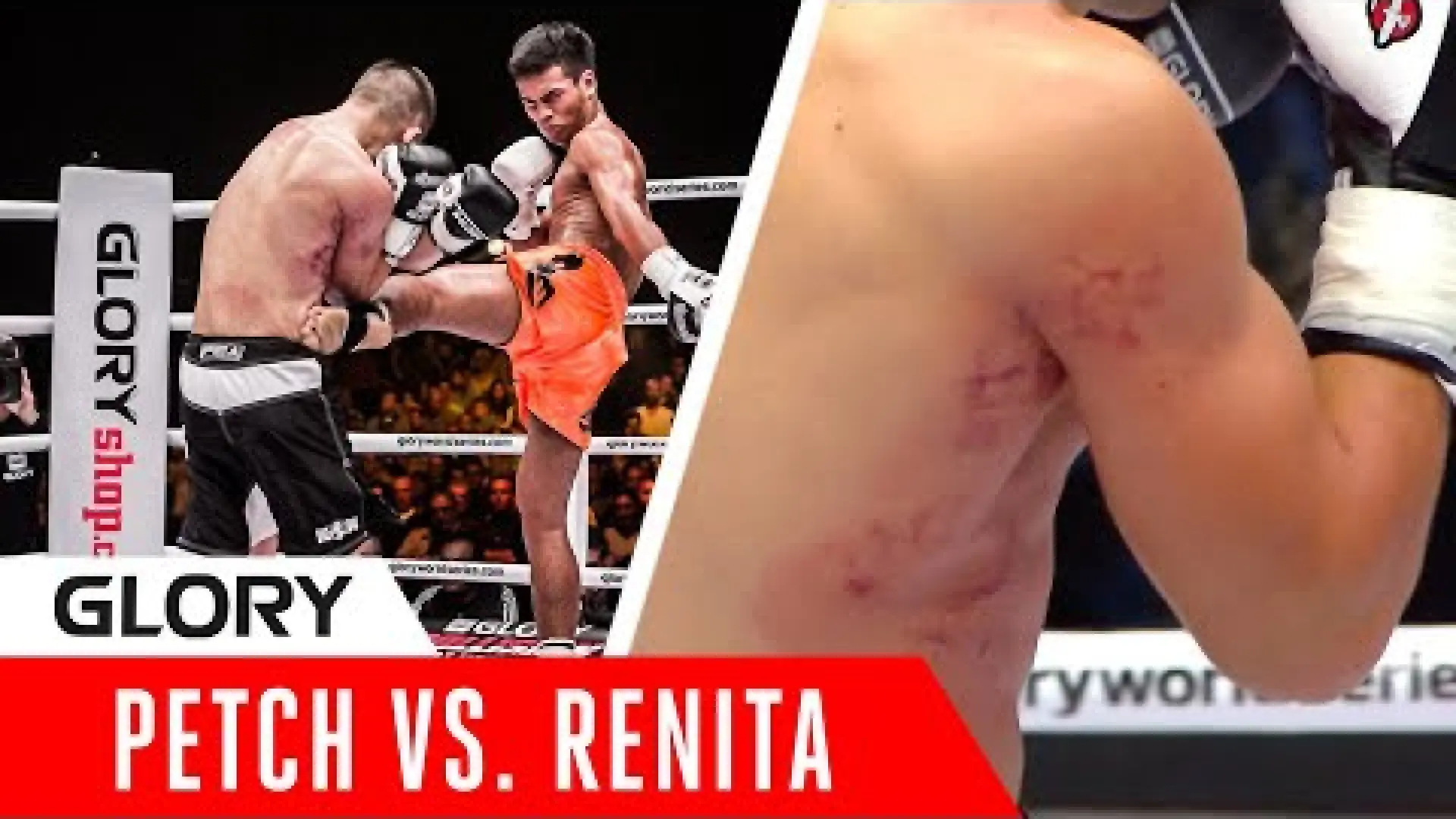 Petpanomrung Kiatmoo9 vs Stanislav Renita (Fight Video)