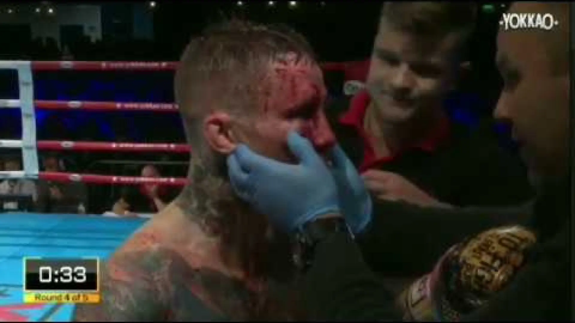 Jeremy Payet vs Craig Dickson (Fight Video)