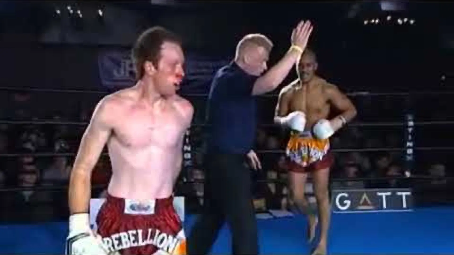 Albert Xavier vs Ryan Tobin (Fight Video)